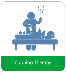 cupping therapy